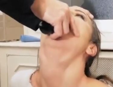 Extreme throat bulging gullet destruction